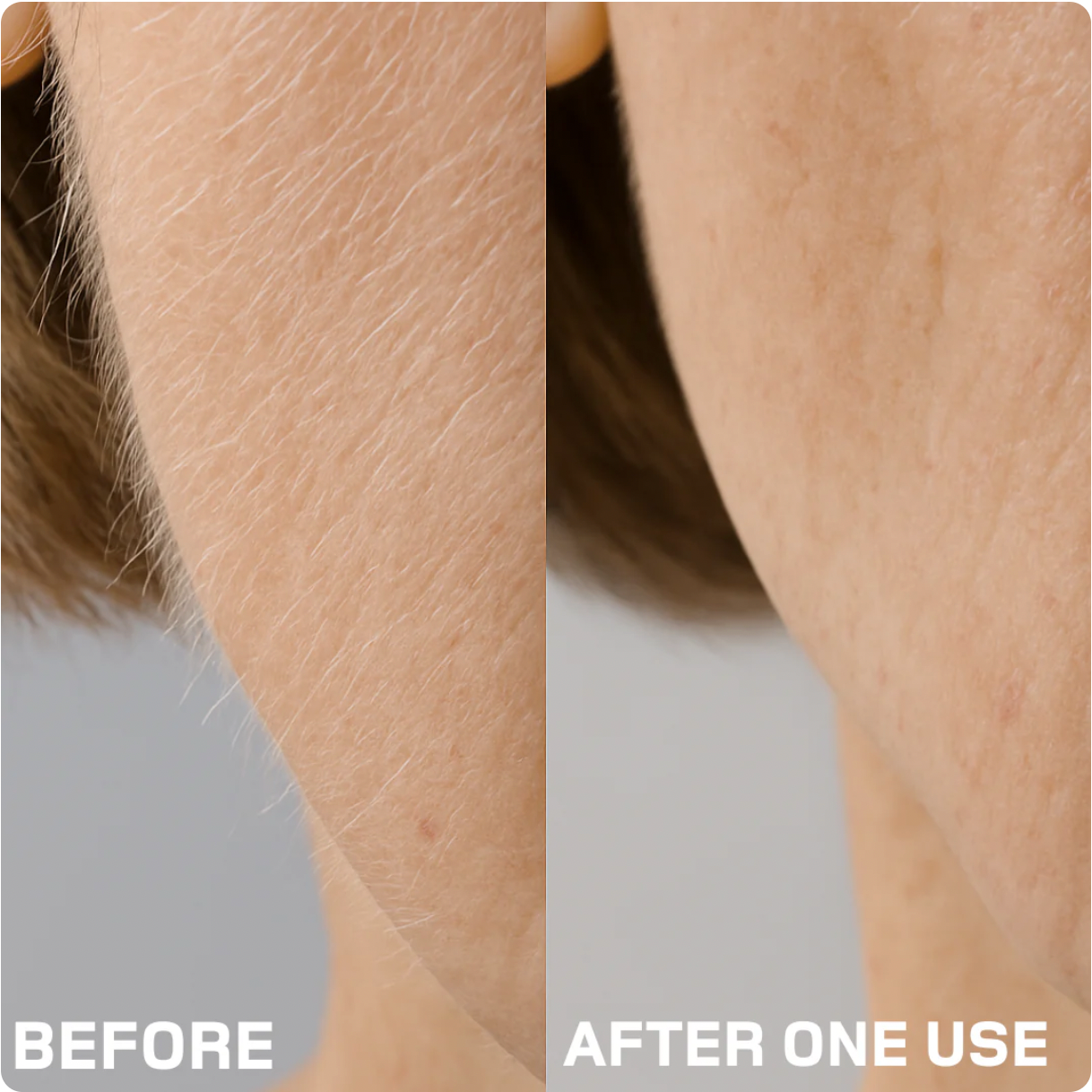 Sonic Dermaplaning Tool