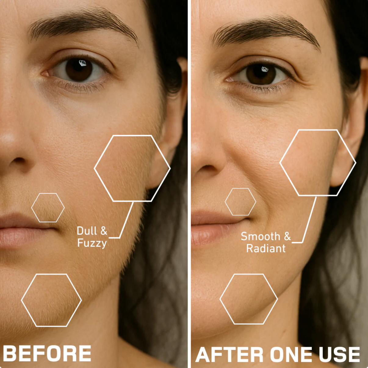 Sonic Dermaplaning Tool